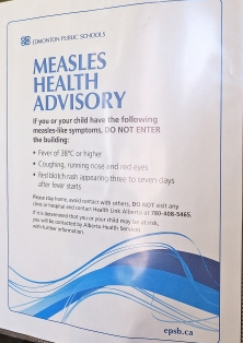 measles alert